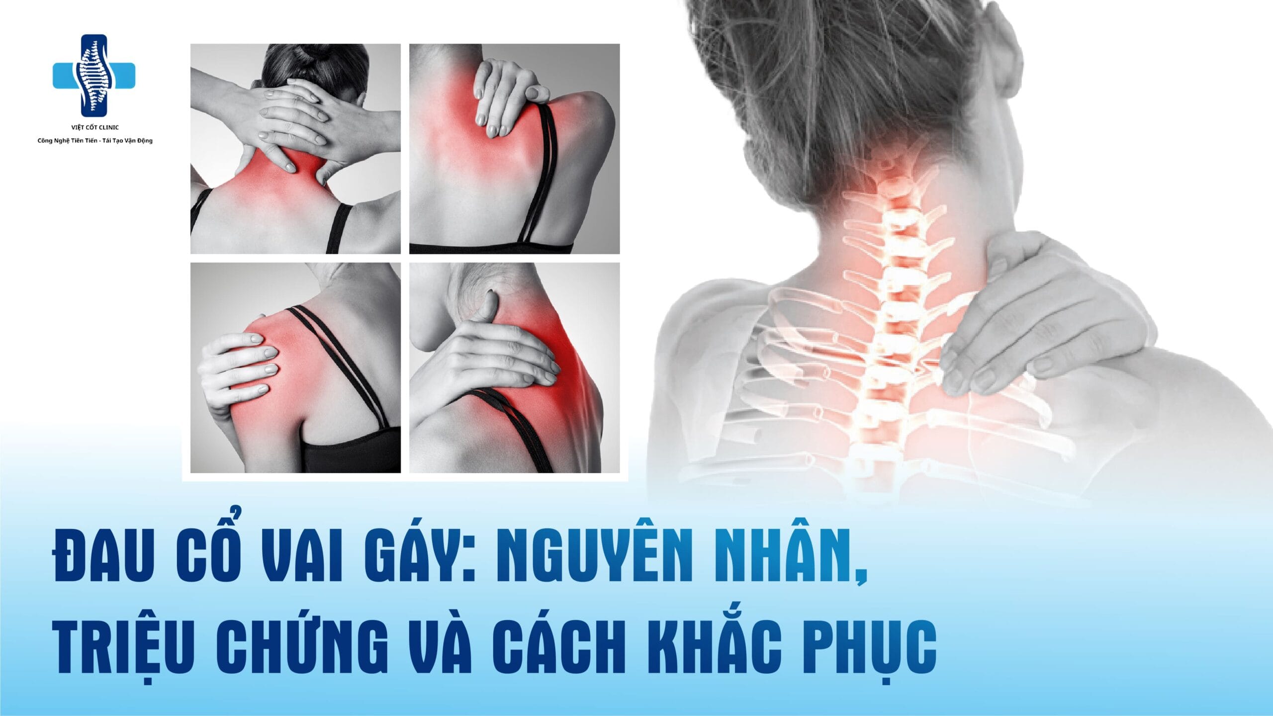 đau cổ vai gáy