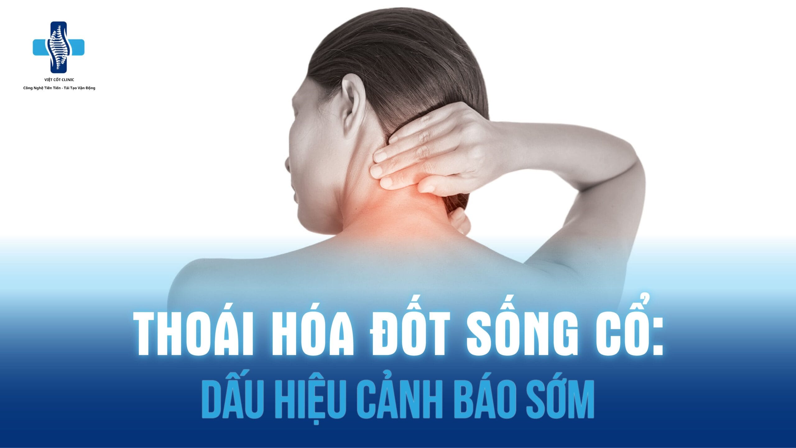 Thoái hóa đốt sống cổ
