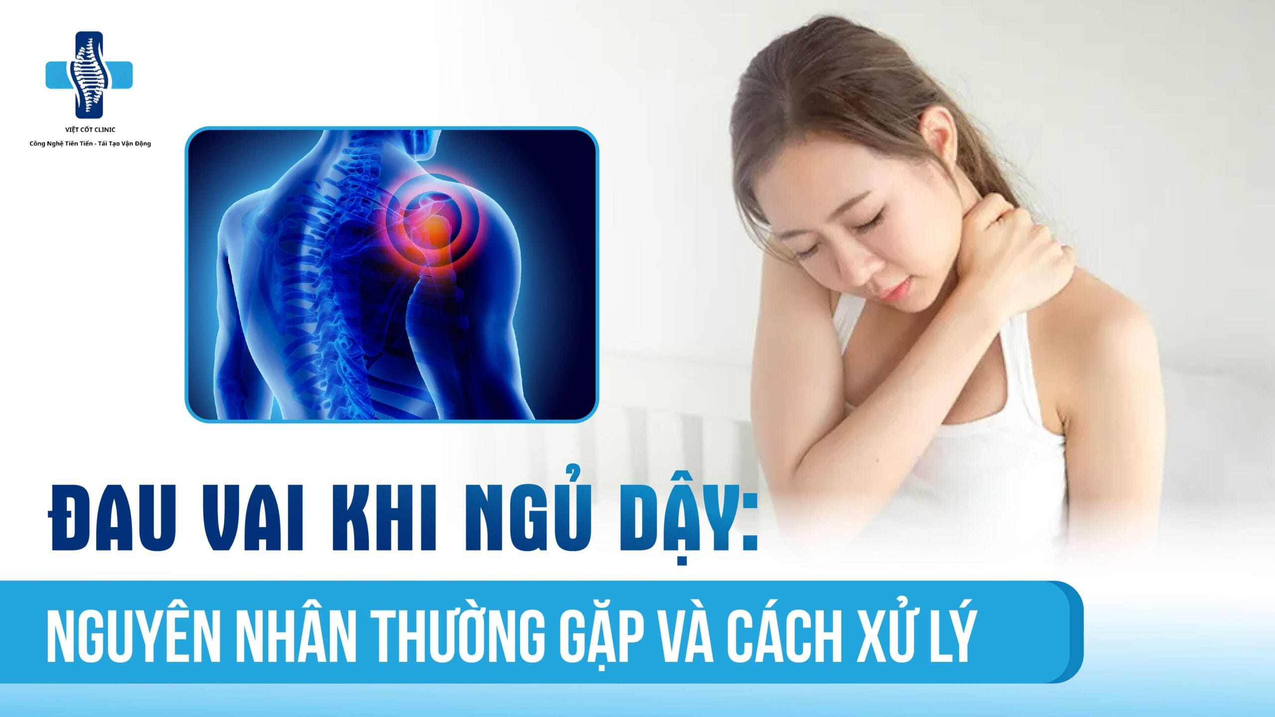 Đau vai khi ngủ dậy