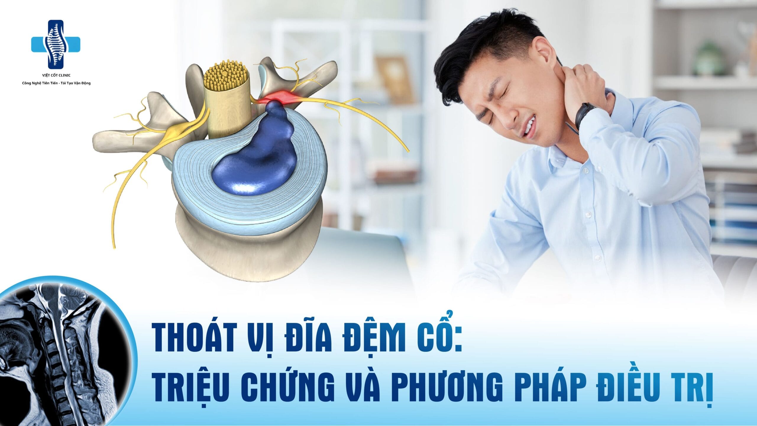 thoát vị đĩa đệm cổ