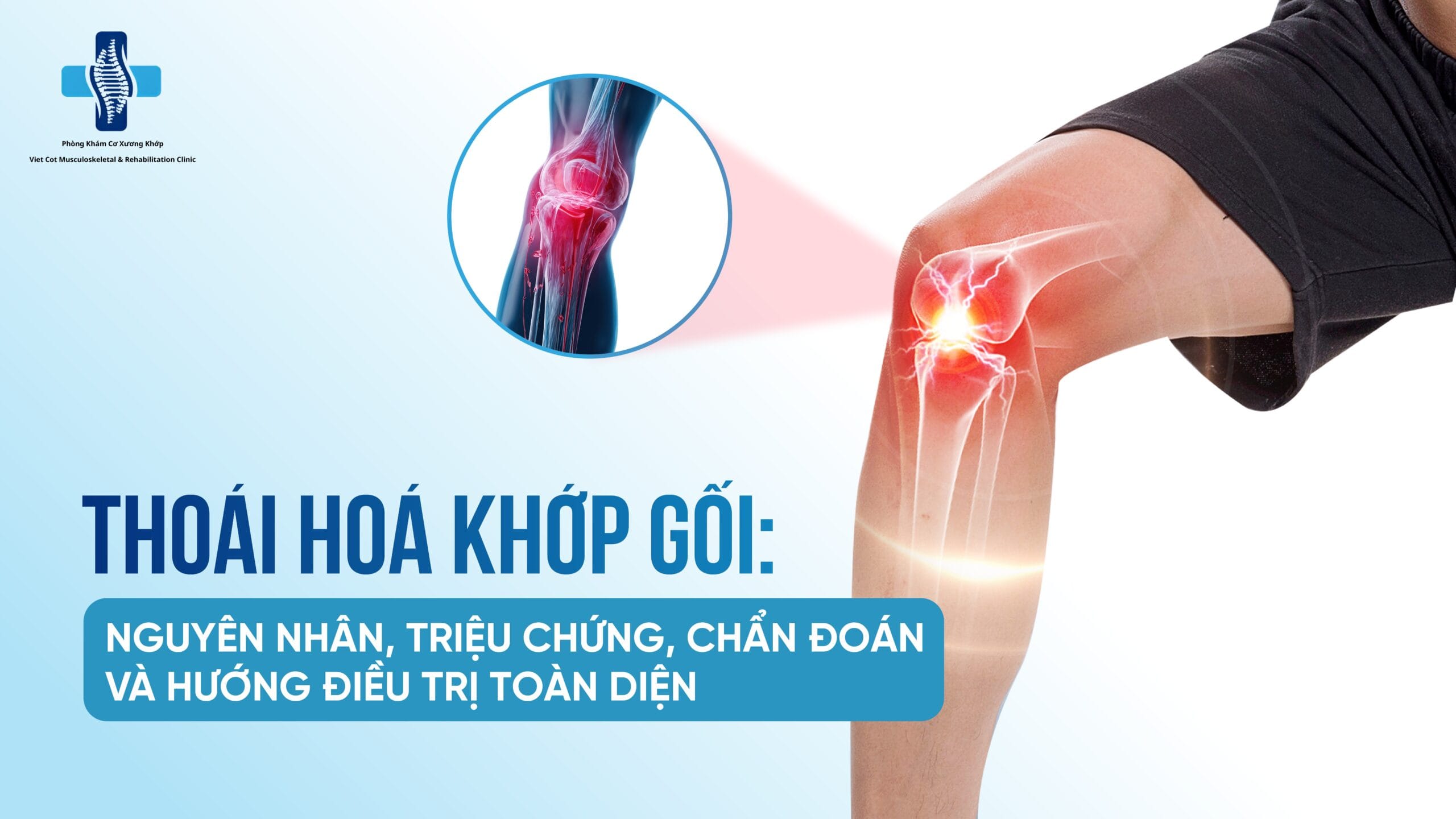 thoái hóa khớp gối