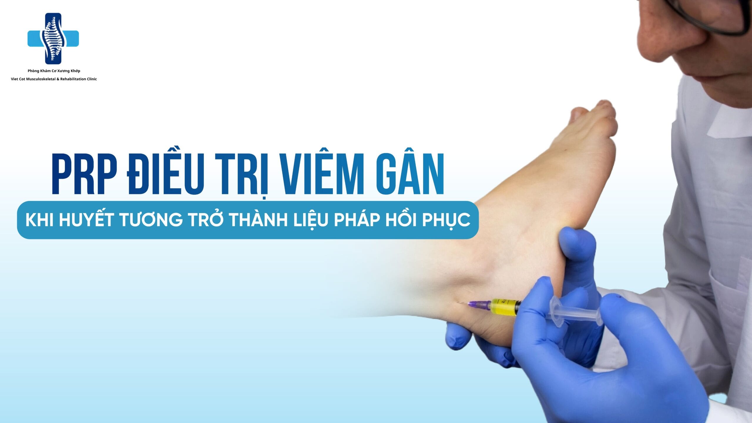 PRP điều trị viêm gân